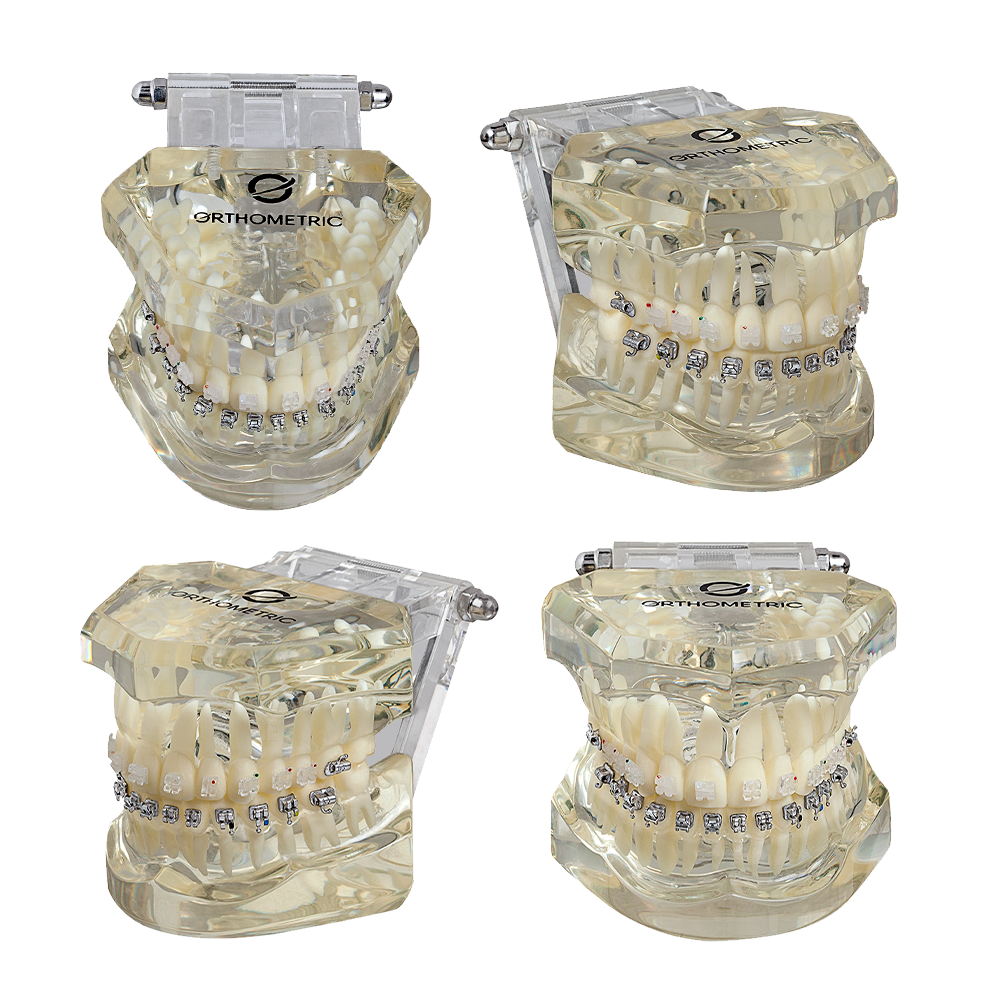 BRACKET ICERAM-P POLY SAFIRO MBT ORTHOMETRIC KIT 5/1 PROMO (01 DENTOFORMO GRATIS)
